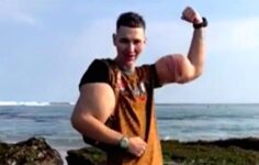 ‘Rus Temel Reis’ Kirill Tereshin, Kolunu Kaybetme Tehlikesiyle Karşı Karşıya