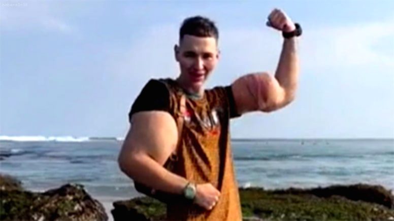 ‘Rus Temel Reis’ Kirill Tereshin, Kolunu Kaybetme Tehlikesiyle Karşı Karşıya