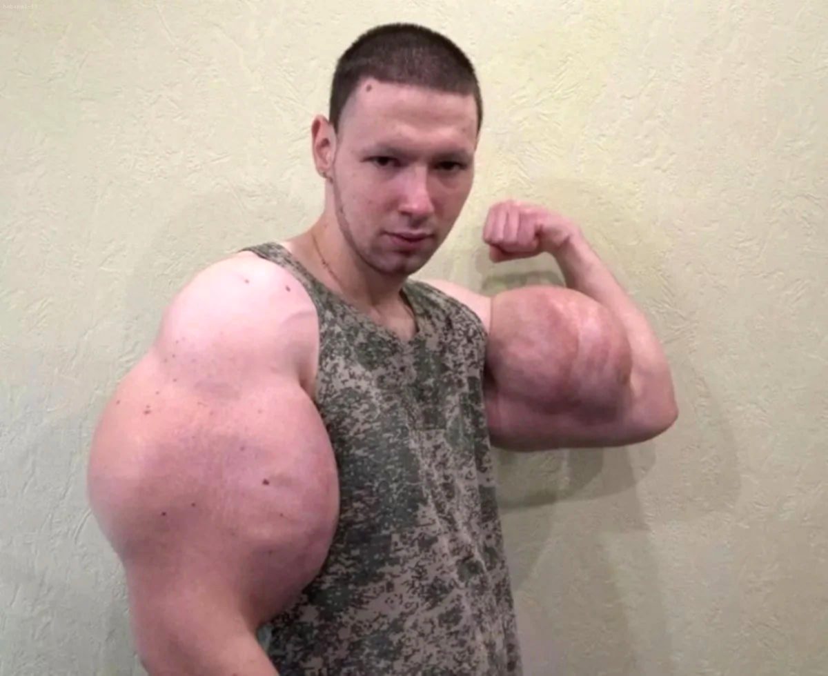 'Rus Temel Reis' Kirill Tereshin, Kolunu Kaybetme Tehlikesiyle Karşı Karşıya