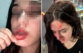 Eski Sevgilinin Tuzak Dehşeti: Genç Kadın Sosyal Medyadan Yardım İstedi