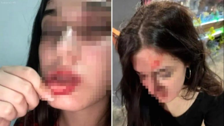 Eski Sevgilinin Tuzak Dehşeti: Genç Kadın Sosyal Medyadan Yardım İstedi