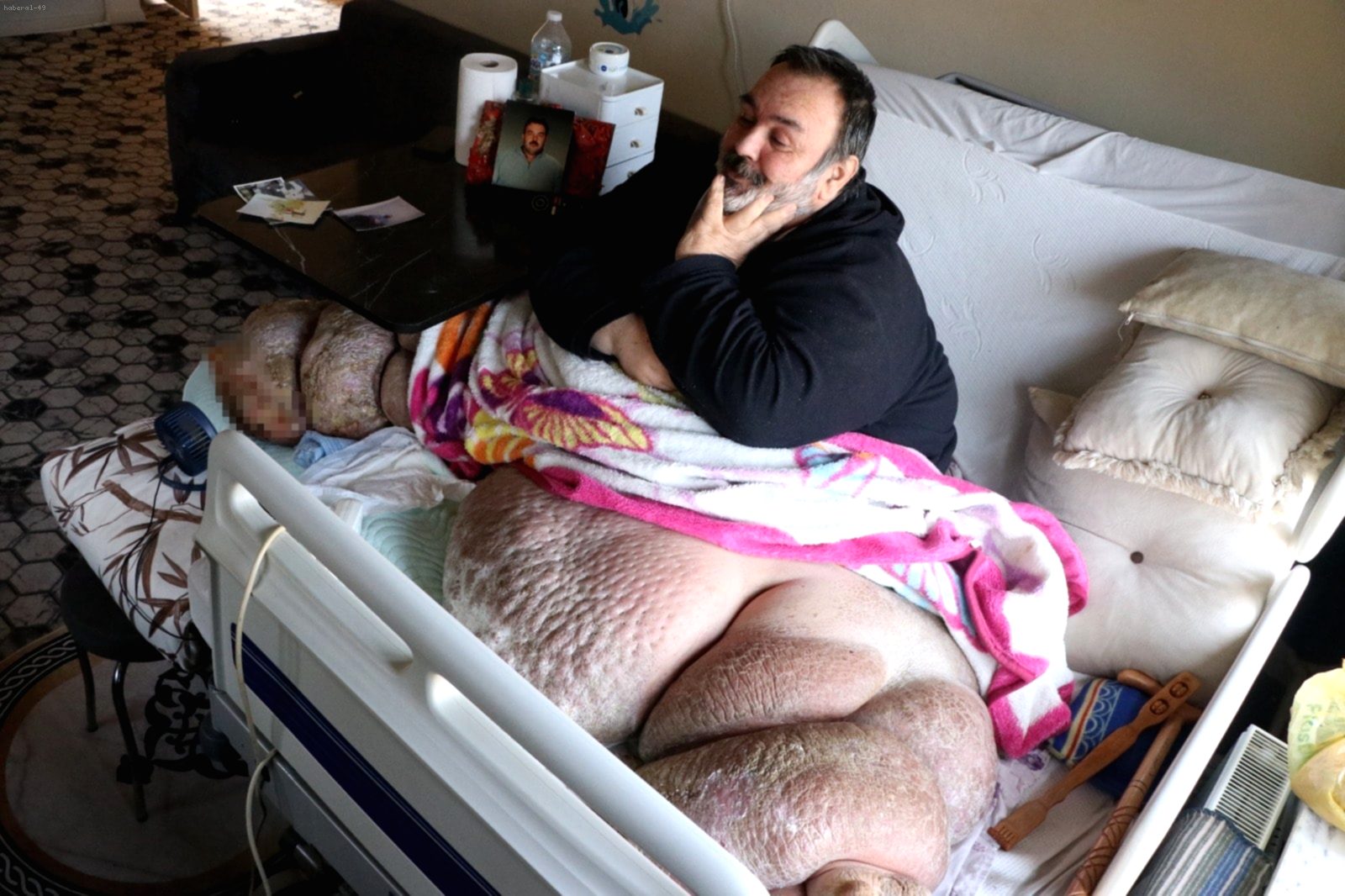 300 Kiloluk Yaşam Mücadelesi: Evine Hapsolan Engin Akbadal'ın Eşiyle Kol Kola Gezme Hayali