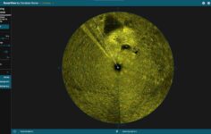 50 Yıllık Sır Perdesi Aralandı: THY’nin Kayıp ‘Bursa’ Uçağının Enkazı Marmara’da İlk Kez Görüntülendi